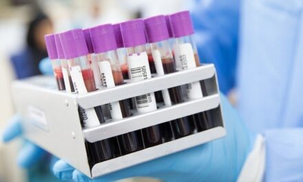 Exame de sangue é capaz de detectar mais de 50 tipos de câncer – Notícias