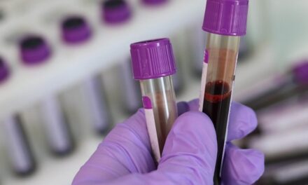 Cientistas encontram moléculas no sangue que indicam demência