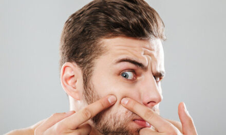 6 orientações importantes para quem sofre com acne no rosto – Beleza