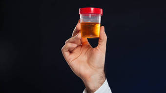 Exame de urina identifica doença de Alzheimer em estágio inicial – Notícias